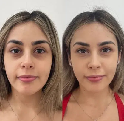 Jabón X2 Unidades Despigmentante con Ácido Kójico y Cúrcuma