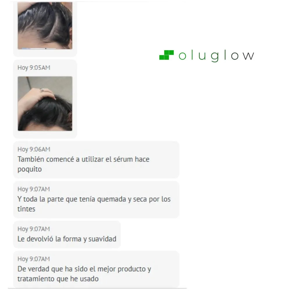 Shampoo Anticaída